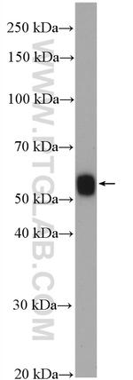 HLA-DMA Antibody in Western Blot (WB)