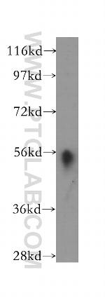 HLA-DMA Antibody in Western Blot (WB)