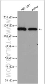 SDCCAG1 Antibody in Western Blot (WB)