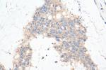 STBD1 Antibody in Immunohistochemistry (Paraffin) (IHC (P))