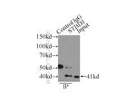 STBD1 Antibody in Immunoprecipitation (IP)