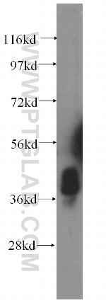 STBD1 Antibody in Western Blot (WB)
