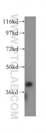 STBD1 Antibody in Western Blot (WB)
