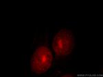 UBE2E2 Antibody in Immunocytochemistry (ICC/IF)