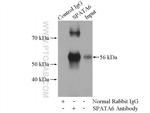 SPATA6 Antibody in Immunoprecipitation (IP)