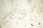 SFTPA1 Antibody in Immunohistochemistry (Paraffin) (IHC (P))
