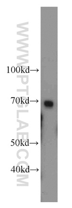 SERPINA10 Antibody in Western Blot (WB)