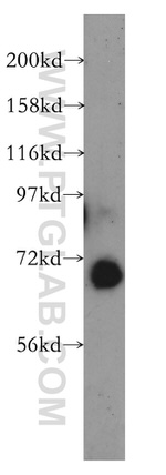 GBP2 Antibody in Western Blot (WB)