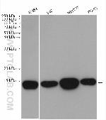 Galectin-1 Antibody in Western Blot (WB)
