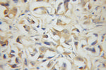 DLEU1 Antibody in Immunohistochemistry (Paraffin) (IHC (P))