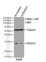 DLEU1 Antibody in Western Blot (WB)