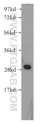 DLEU1 Antibody in Western Blot (WB)