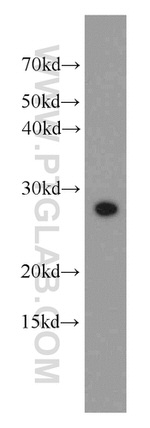 DLEU1 Antibody in Western Blot (WB)