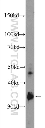 FCN3 Antibody in Western Blot (WB)