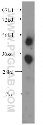 FCN3 Antibody in Western Blot (WB)