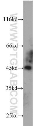 TTC4 Antibody in Western Blot (WB)