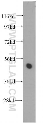 TTC4 Antibody in Western Blot (WB)