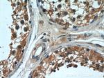 OSBPL9 Antibody in Immunohistochemistry (Paraffin) (IHC (P))