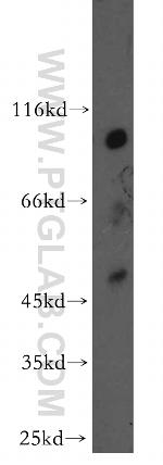 OSBPL9 Antibody in Western Blot (WB)