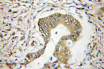 OSBPL9 Antibody in Immunohistochemistry (Paraffin) (IHC (P))