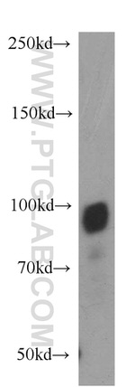 OSBPL9 Antibody in Western Blot (WB)