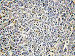 KLF4 Antibody in Immunohistochemistry (Paraffin) (IHC (P))