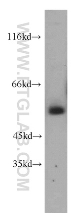 KLF4 Antibody in Western Blot (WB)