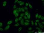 RBBP6 Antibody in Immunocytochemistry (ICC/IF)