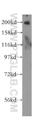 RBBP6 Antibody in Western Blot (WB)