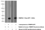 RBBP6 Antibody in Western Blot (WB)