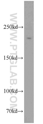 RBBP6 Antibody in Western Blot (WB)
