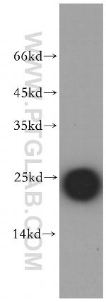 CSHL1 Antibody in Western Blot (WB)