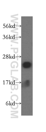 CSHL1 Antibody in Western Blot (WB)