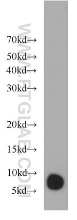 GNGT1 Antibody in Western Blot (WB)