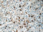 TRA Antibody in Immunohistochemistry (Paraffin) (IHC (P))