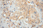 Prealbumin/transthyretin Antibody in Immunohistochemistry (Paraffin) (IHC (P))