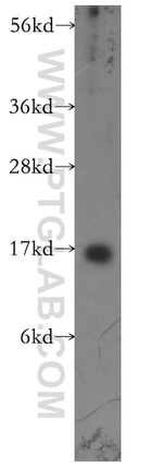 Prealbumin/transthyretin Antibody in Western Blot (WB)