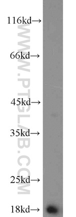 Prealbumin/transthyretin Antibody in Western Blot (WB)