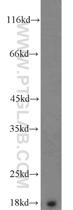 Prealbumin/transthyretin Antibody in Western Blot (WB)
