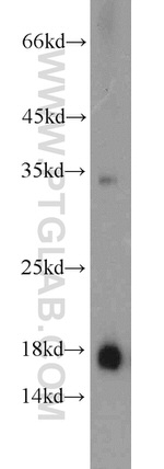 Prealbumin/transthyretin Antibody in Western Blot (WB)