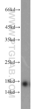 Prealbumin/transthyretin Antibody in Western Blot (WB)