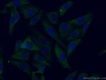 Apolipoprotein H Antibody in Immunocytochemistry (ICC/IF)