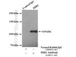 MIB1 Antibody in Immunoprecipitation (IP)