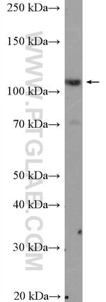 MIB1 Antibody in Western Blot (WB)