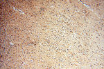 TERF1 Antibody in Immunohistochemistry (Paraffin) (IHC (P))