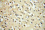 TERF1 Antibody in Immunohistochemistry (Paraffin) (IHC (P))