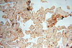 TERF1 Antibody in Immunohistochemistry (Paraffin) (IHC (P))