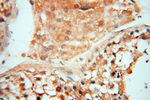 TERF1 Antibody in Immunohistochemistry (Paraffin) (IHC (P))