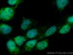 DGKE Antibody in Immunocytochemistry (ICC/IF)