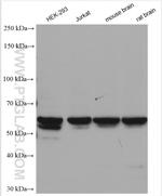 DGKE Antibody in Western Blot (WB)